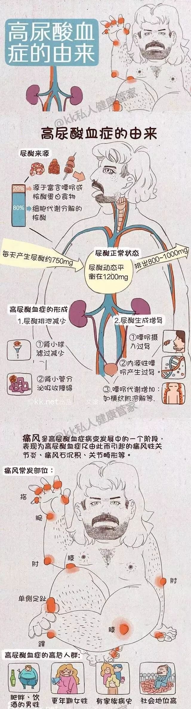 谨防高尿酸!1.7亿国人已患上的"第四高"