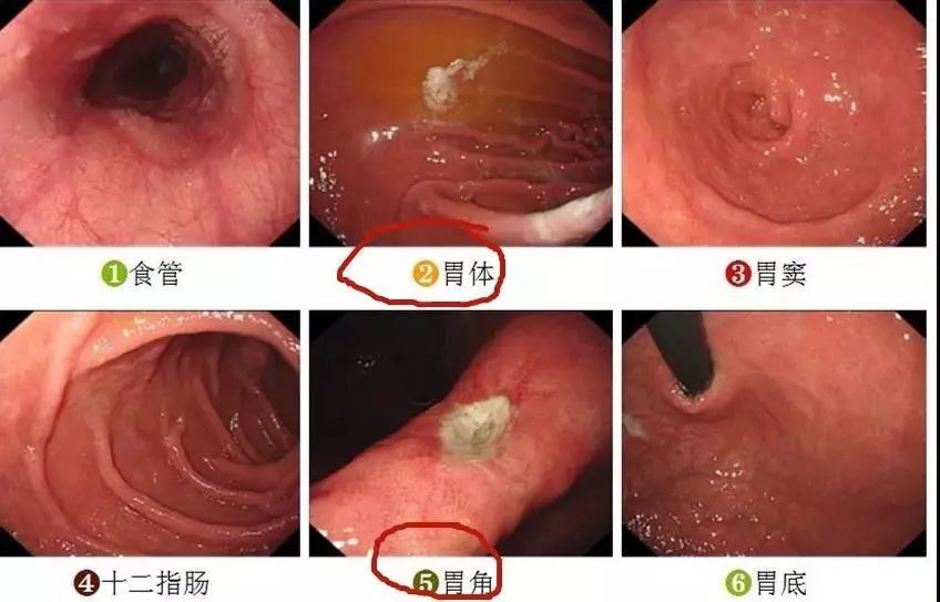 胃镜检查的解剖位置图图片