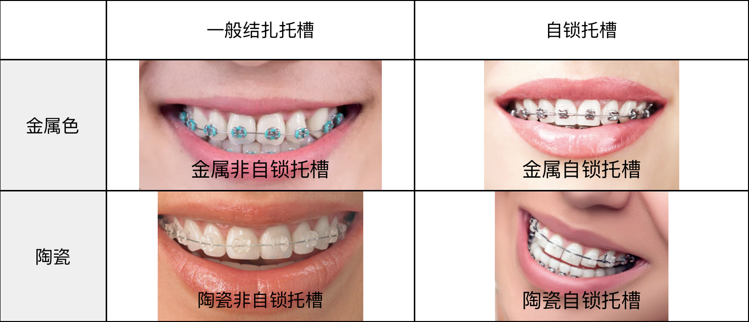 托槽的种类和区别图片