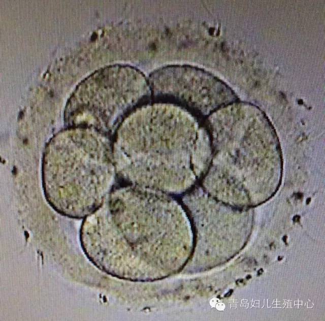 一级八细胞胚胎照片图片