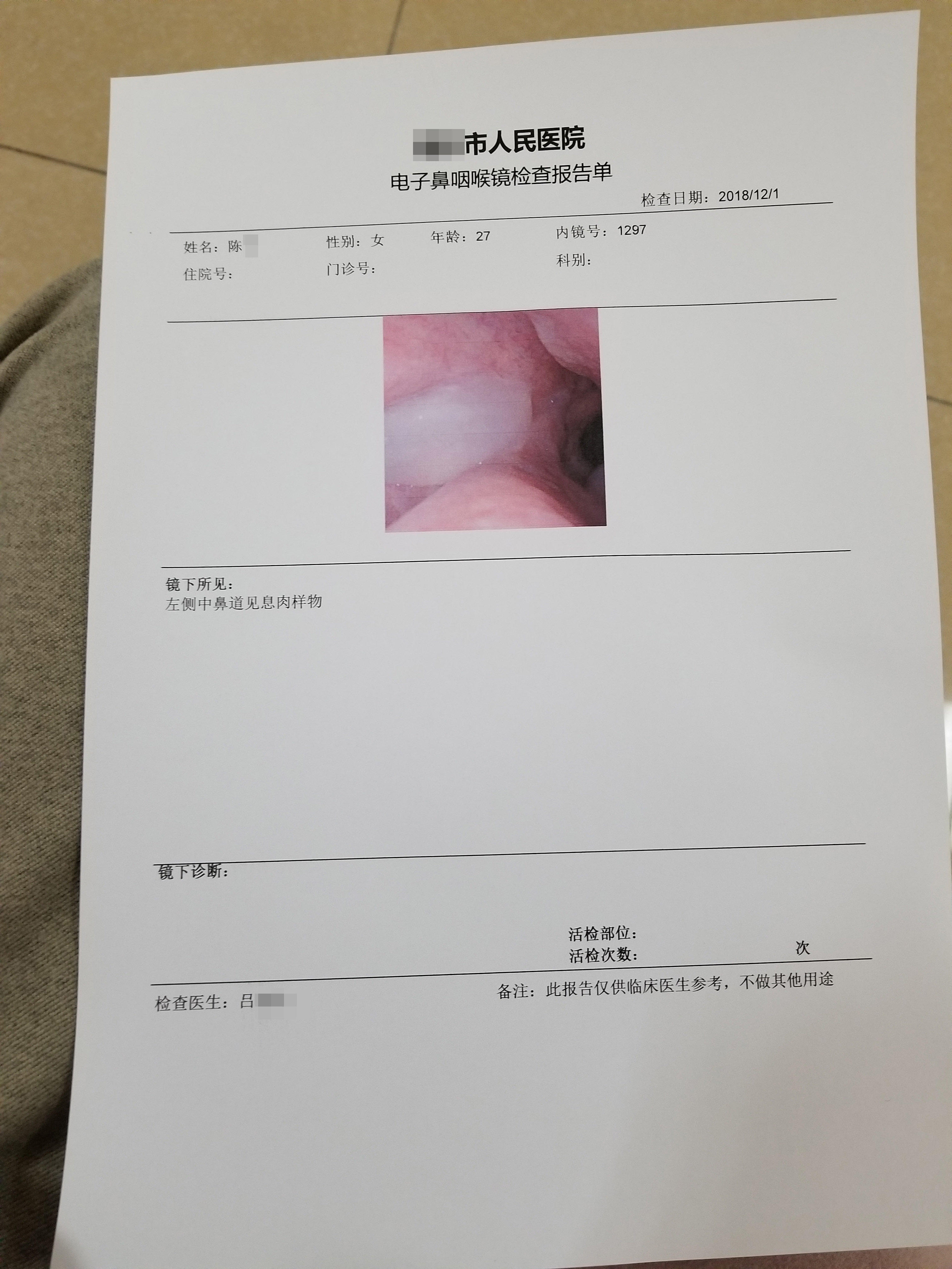 患者自述慢性鼻鼻窦炎伴鼻息肉如何检查诊断