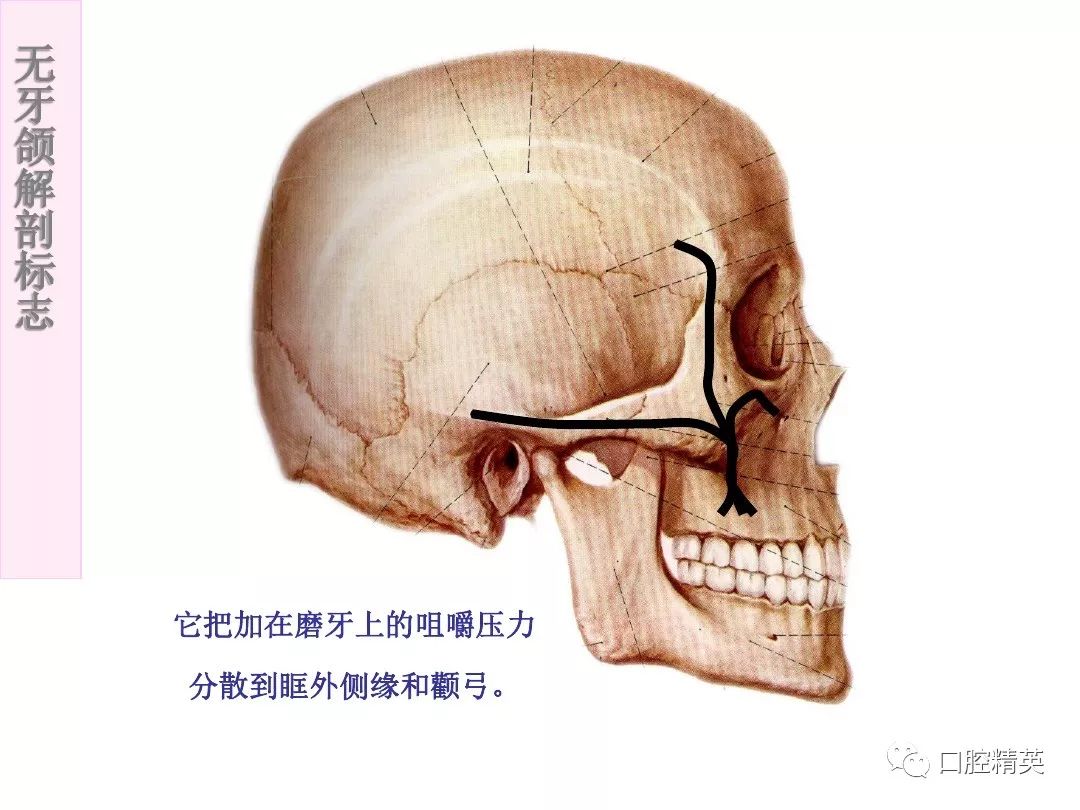 无牙颌解剖标志