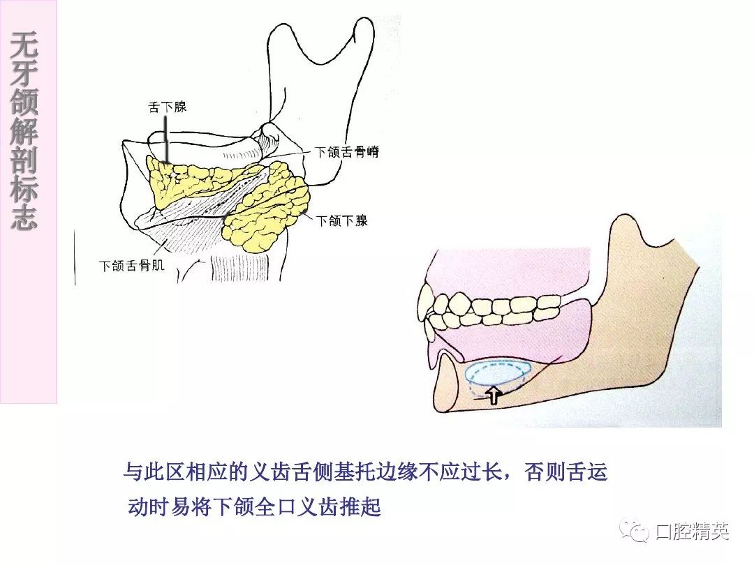 无牙颌解剖标志