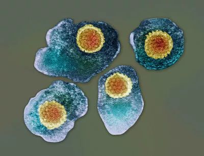 水痘病毒显微镜图片图片