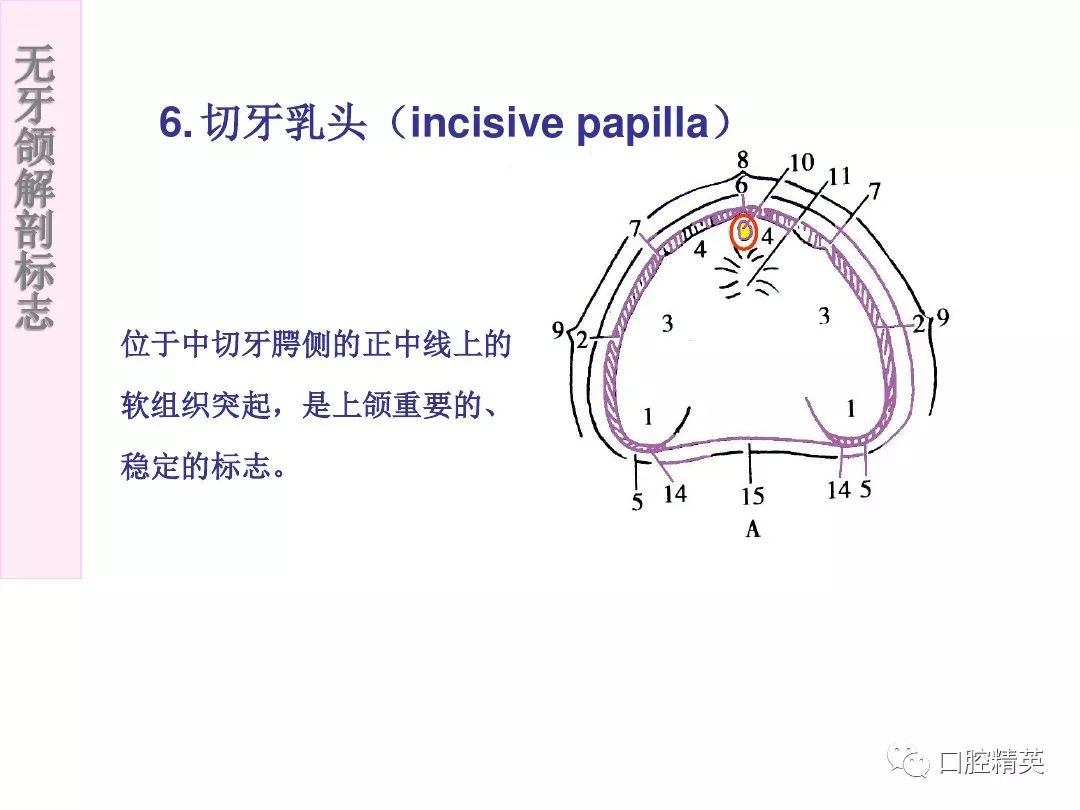 無牙頜解剖標誌