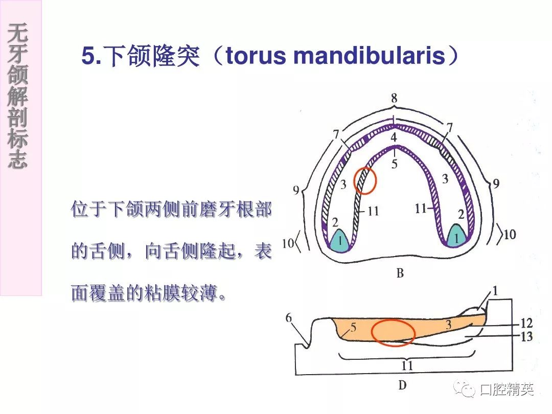 疝死亡冠血管解剖彩图图片