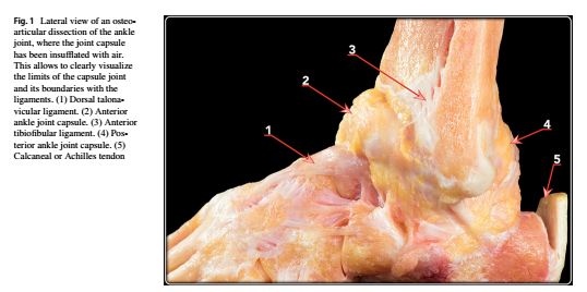 外側腓距跟韌帶複合體:踝關節穩定的一種等長結構_解剖