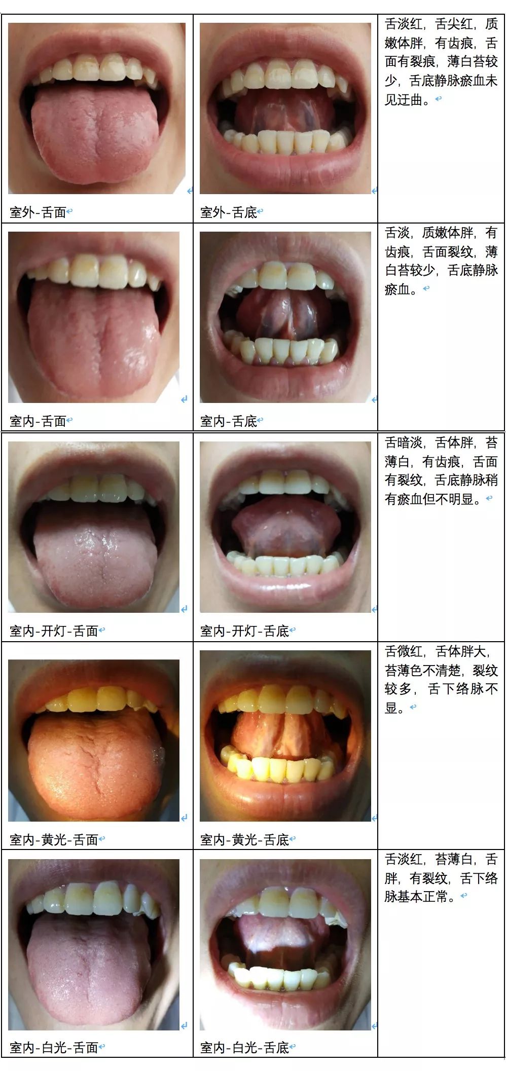 中医看舌苔图片与疾病图片