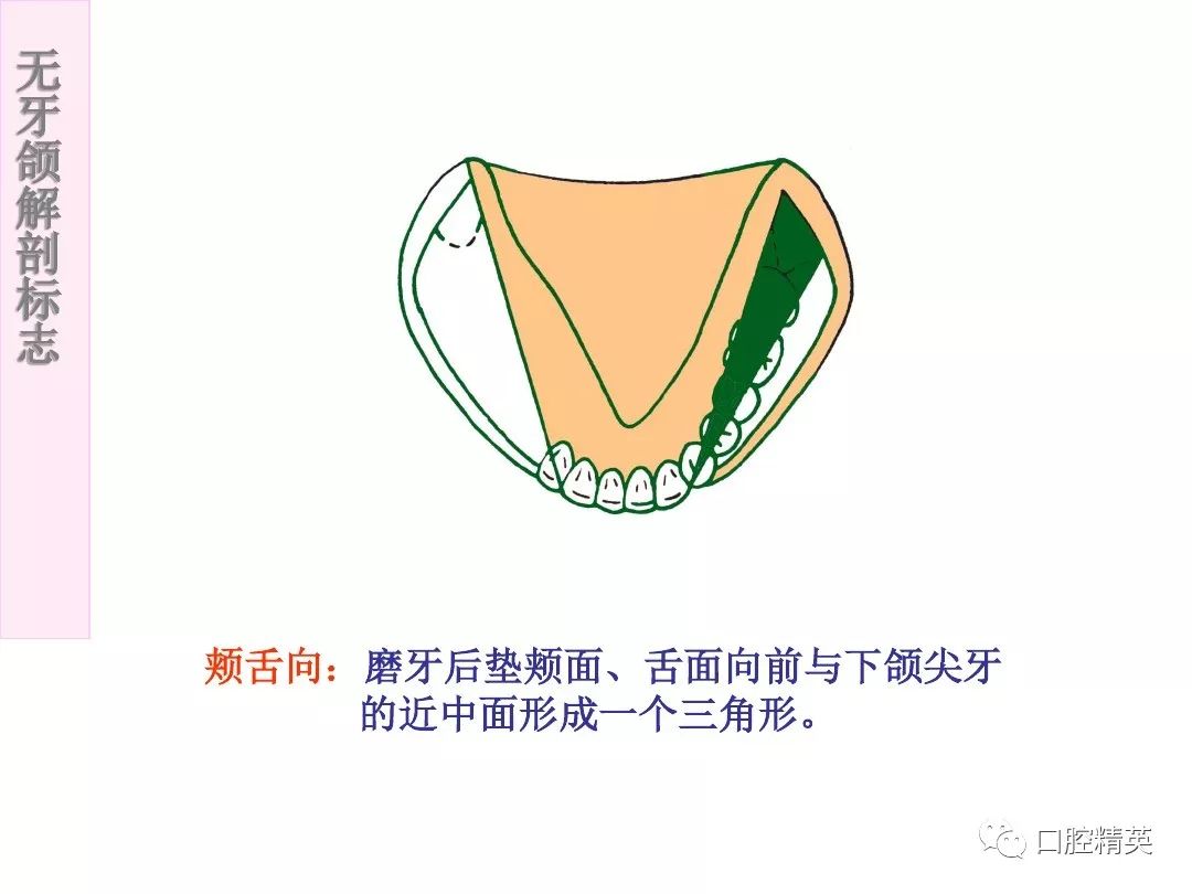 无牙颌的分区图片