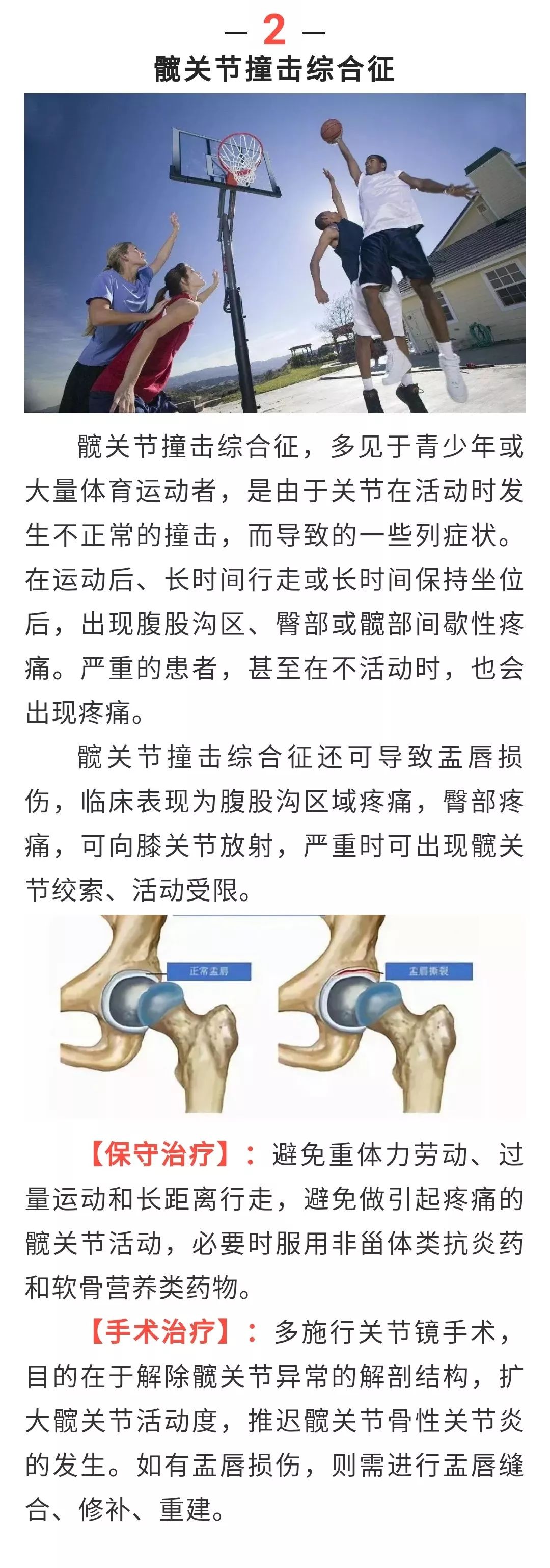 胯骨痛,哪里都痛,你到底怎么啦?