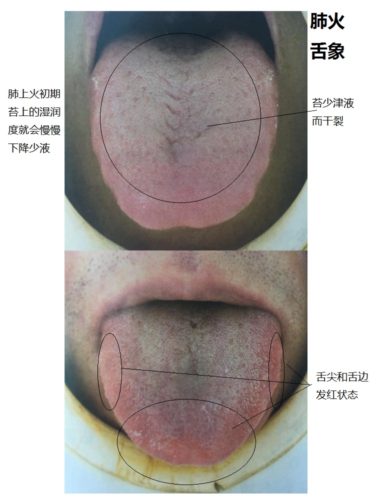 舌头根部长痘痘图片图片