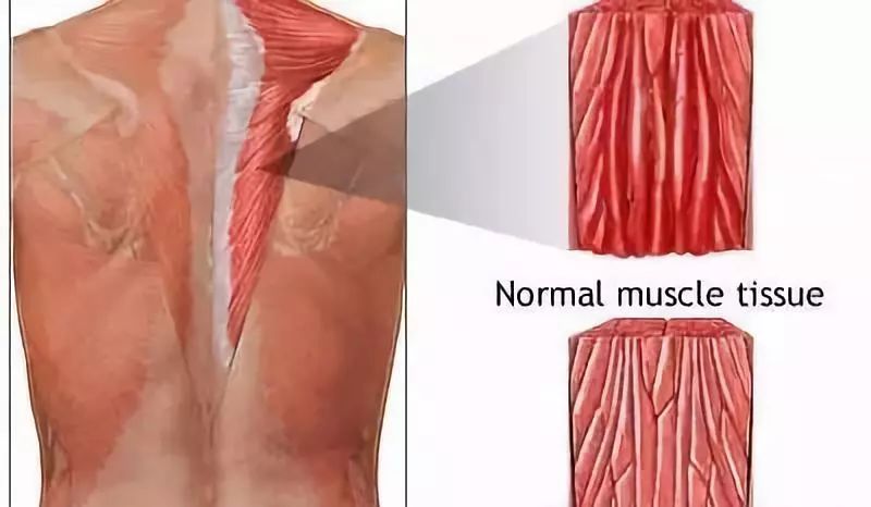 muscletissue图片