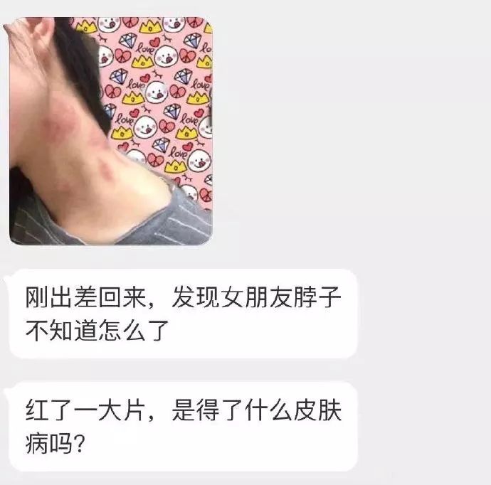 出差回来发现女友脖子上多了草莓印朋友说这是绿藓