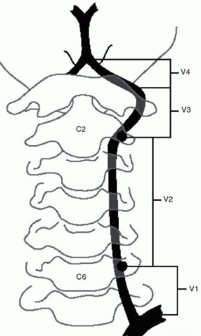 椎动脉血管的位置图片图片