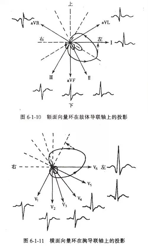 v2~v5(v1)(v6)前壁: v3,v4,v5前間壁:v1,v2,v3(三),心肌梗死的定位