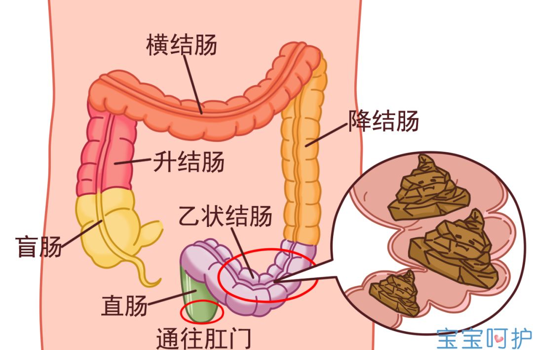 由于肠道结构异常,比如肛门括约肌狭窄,乙状结肠冗长等,或者肠道蠕动