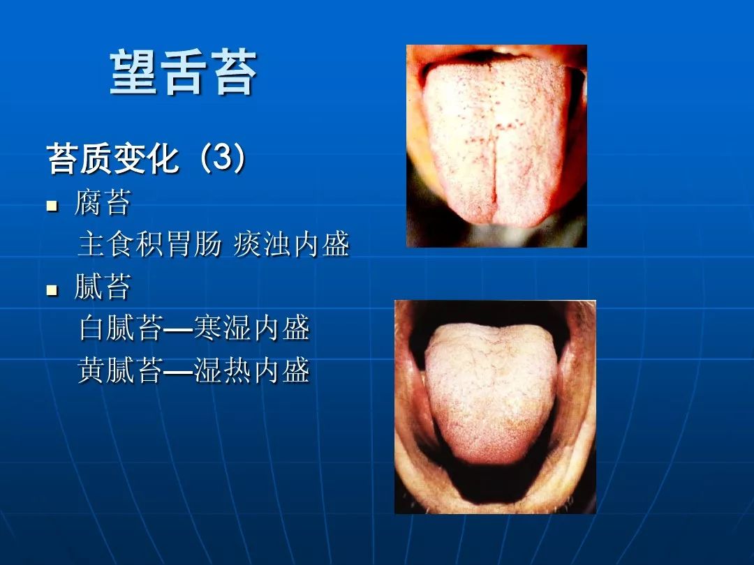 中醫舌診圖解