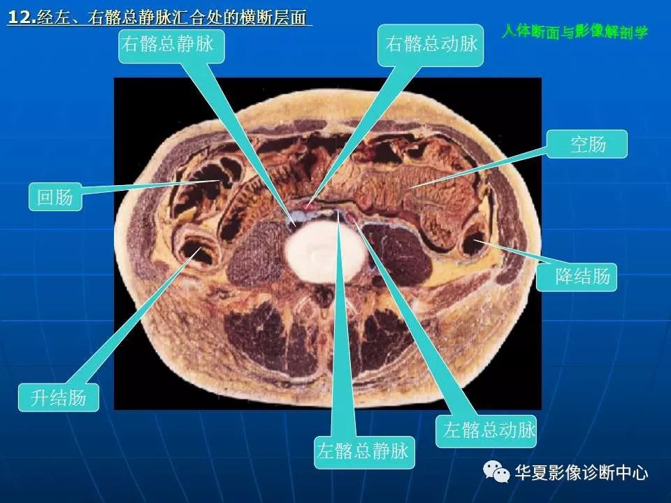 腹部斷層影像解剖