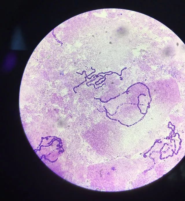 果蝇唾液腺染色体图片图片