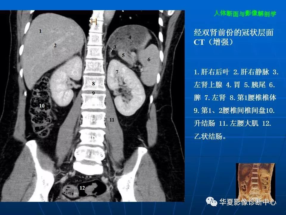 腹部断层影像解剖续