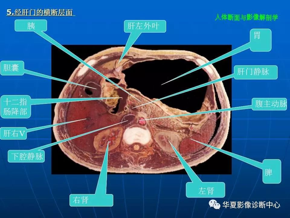 腹部斷層影像解剖