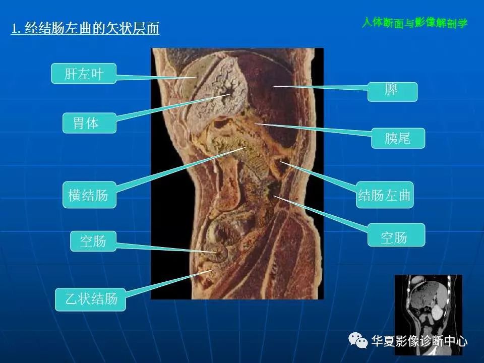 腹部斷層影像解剖續