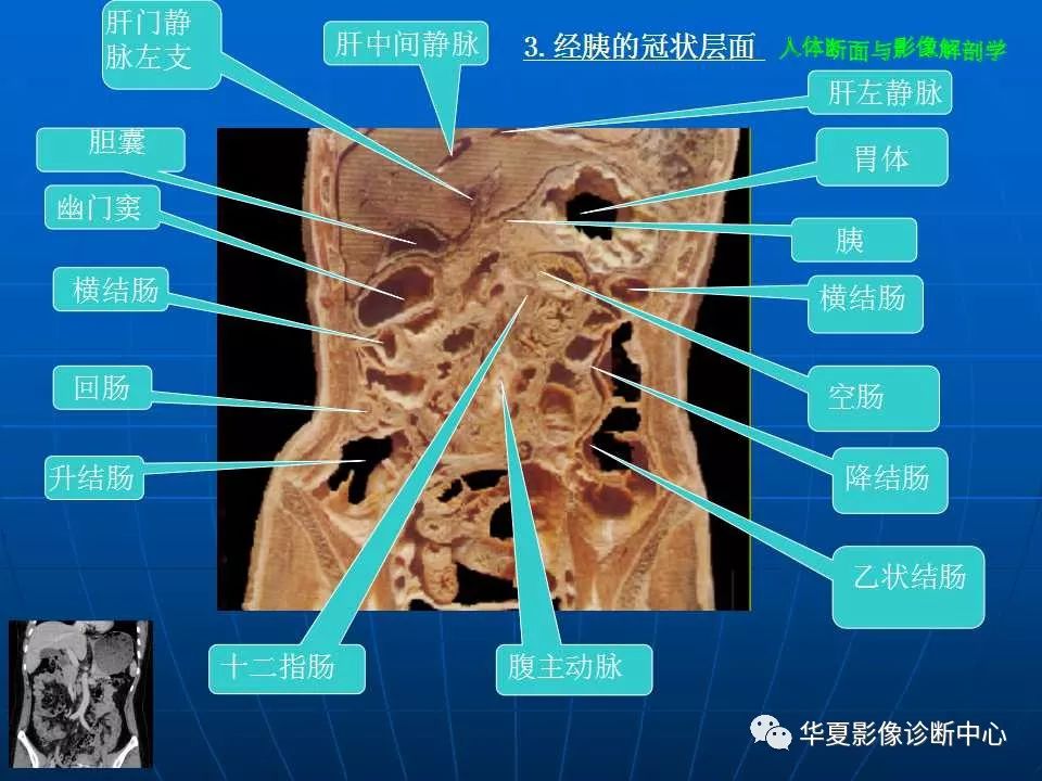 腹脂线影像图片位置图片