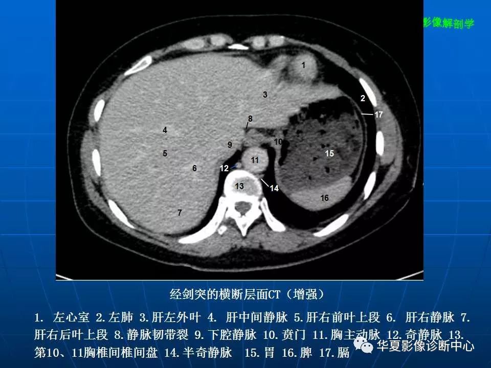 腹部斷層影像解剖續