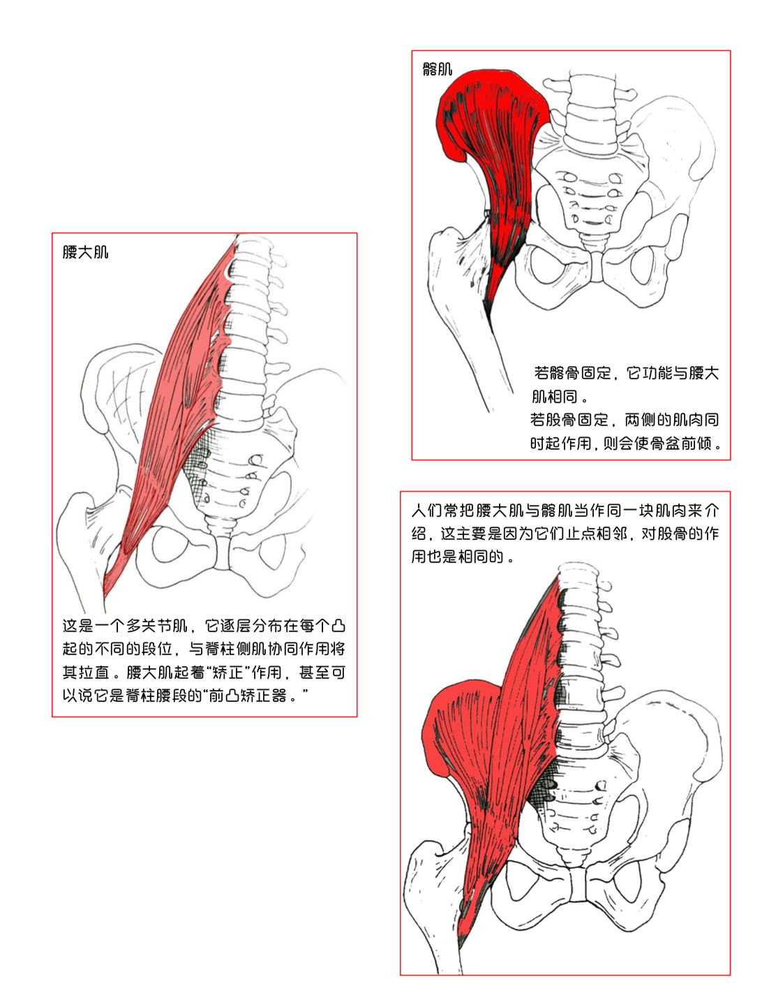 髂肌 松解图片