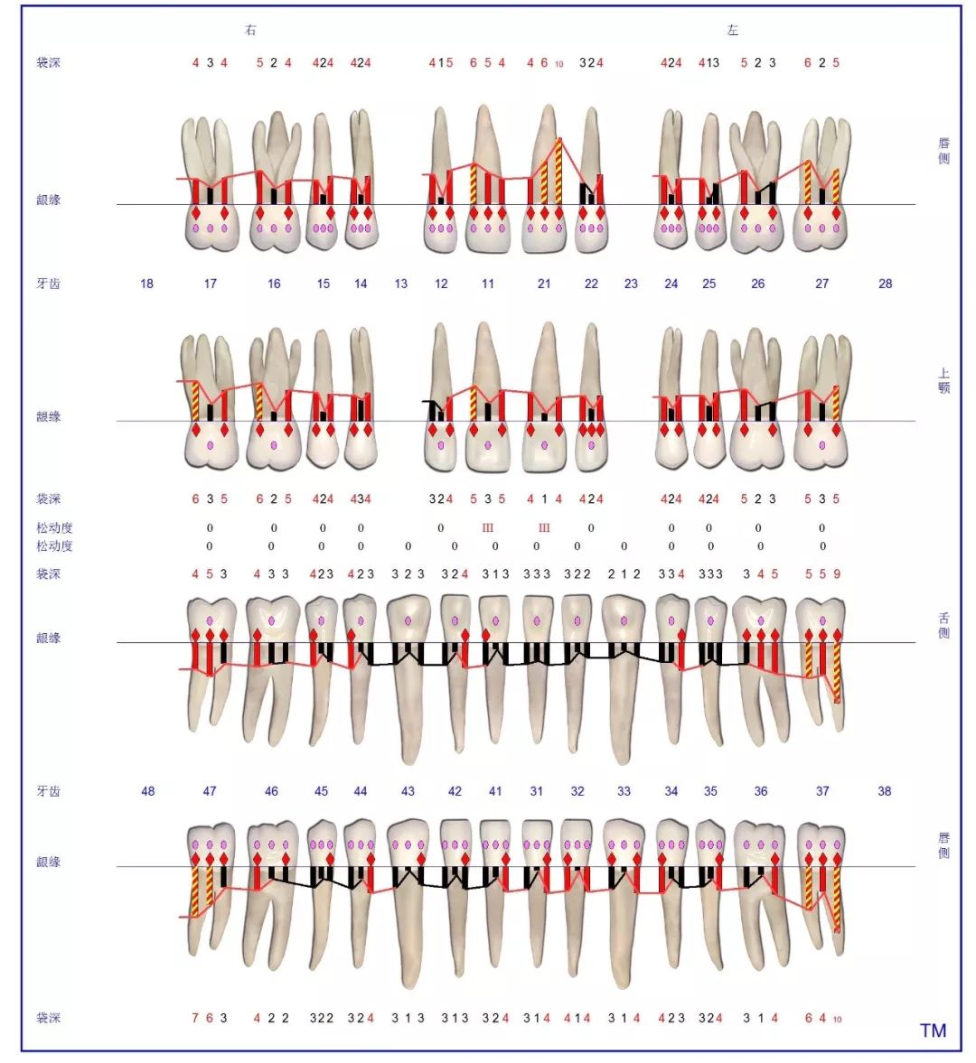牙周大表图解析图片