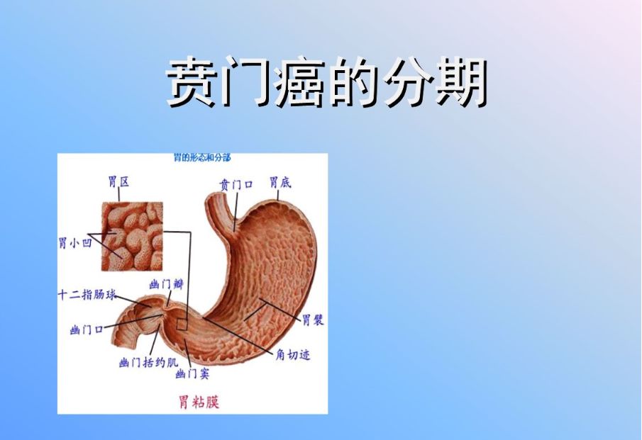 贲门癌有什么症状图片