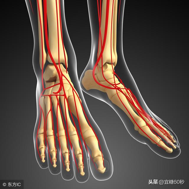 脚出现3种改变,请接受事实:十有八九是糖尿病足