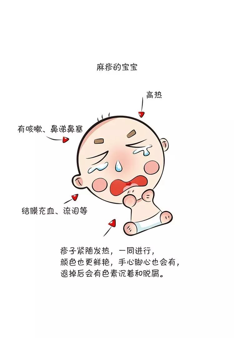 幼儿急疹图片卡通图片图片