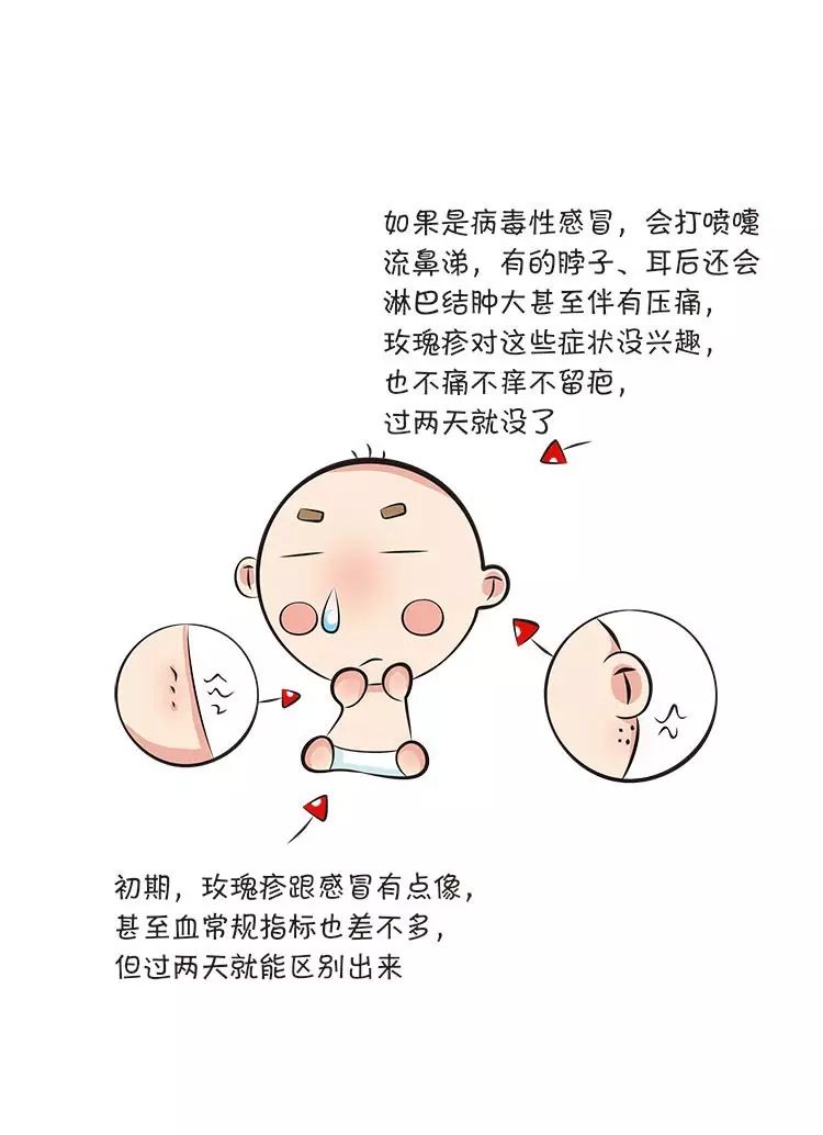 幼儿急疹图片卡通图片图片