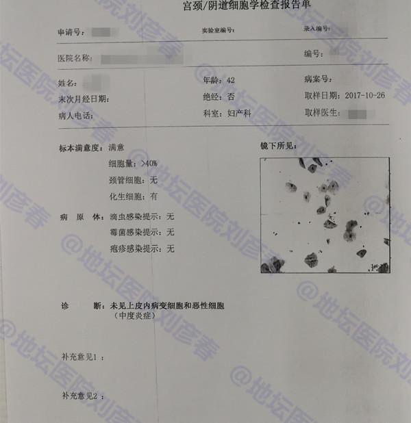 病例分享—兩次宮頸病變,兩次錐切術後又發現了hpv病毒怎麼辦?