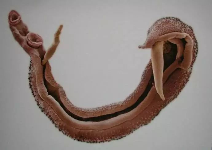 血吸虫尾蚴性皮炎图片