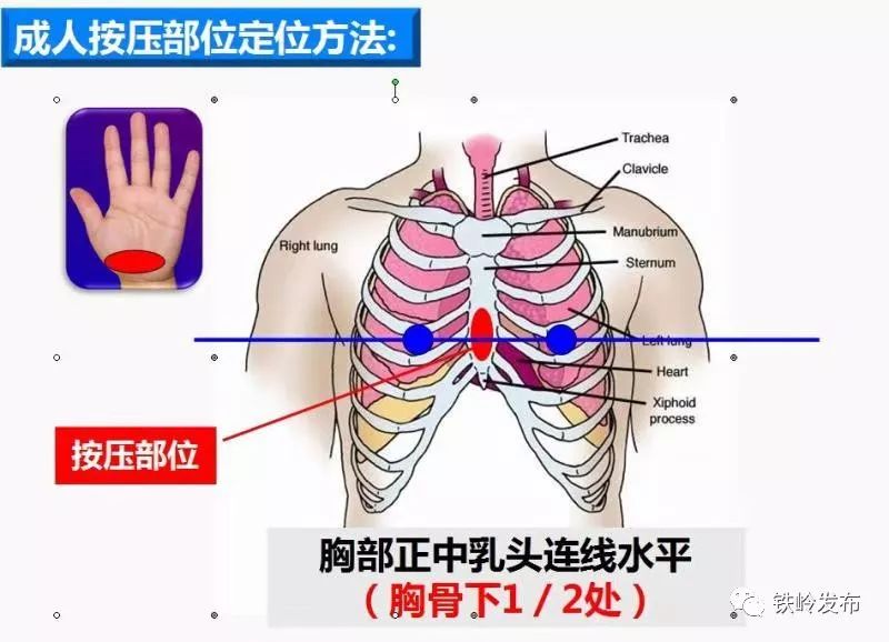 心脏定位标志及定位图片