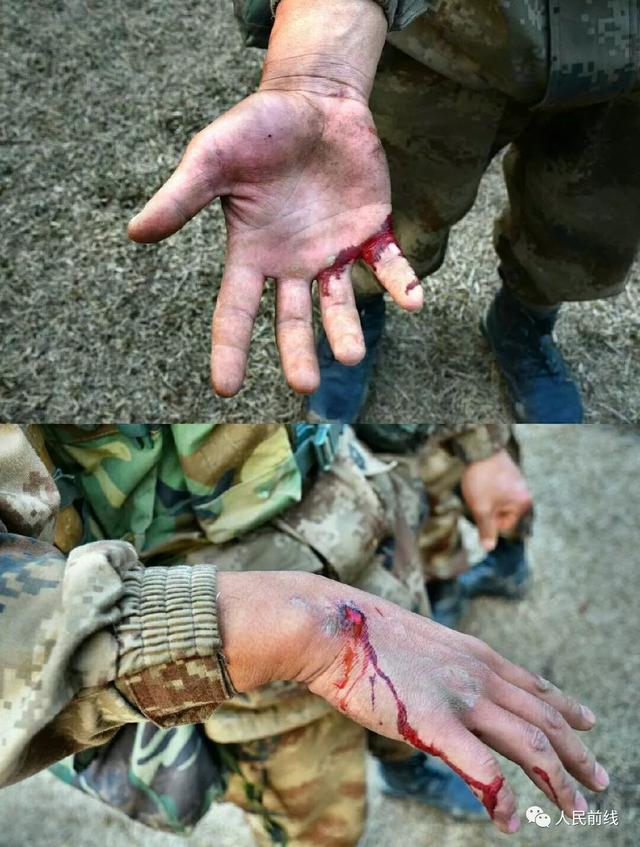 军人浑身是伤疤的照片图片