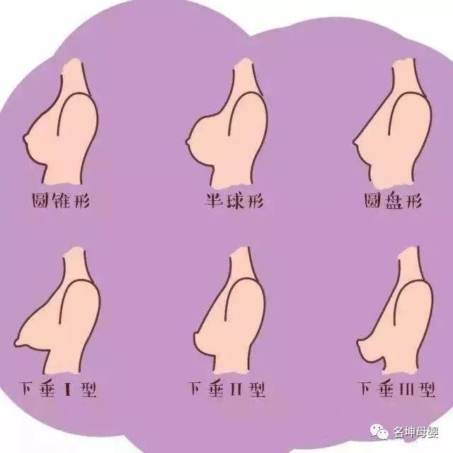 乳房图凹陷图片