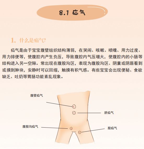 女宝疝气的症状图片