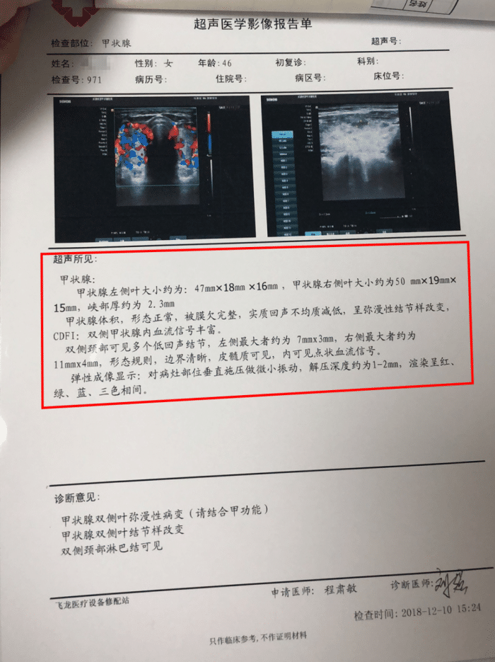 甲狀腺結節分為良惡性兩種我們該如何分辨其性質