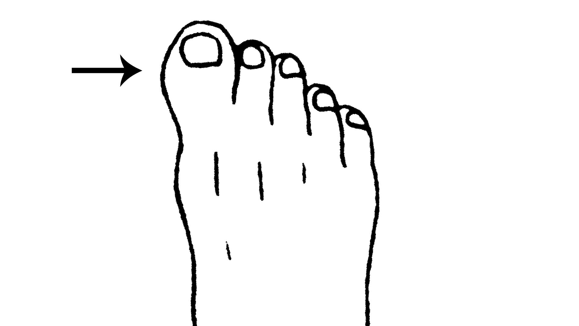 看脚趾脚趾的异常是身体的求救信号