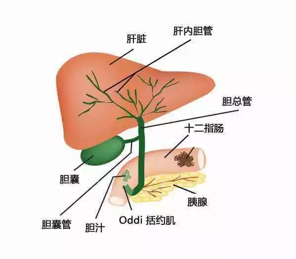 诱发胆道感染且只提供单向阀门,结石堆积或变大而胆总管下段oddis