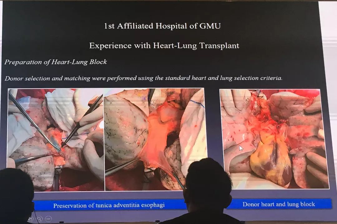 何建行从肺移植到心肺联合移植内含视频ppt