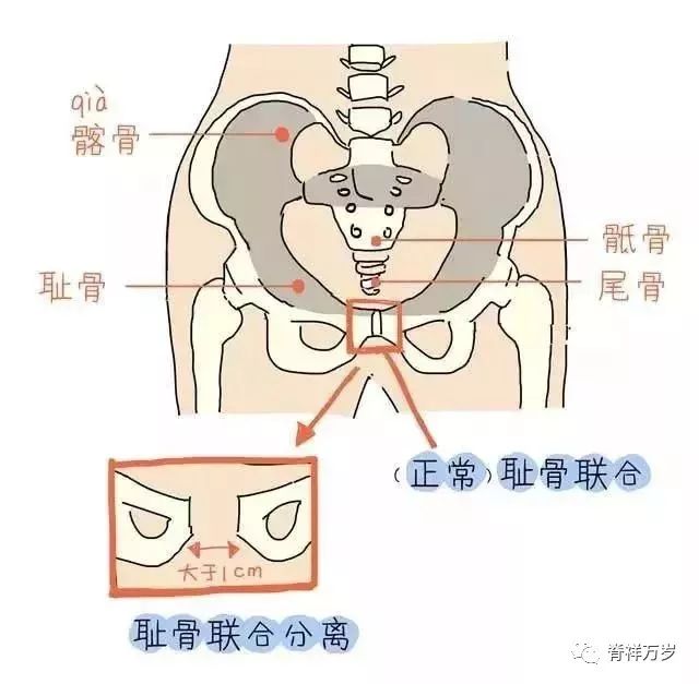 臀骨在哪个位置图片图片