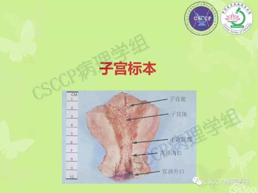 宮頸與子宮病變病理標本取材