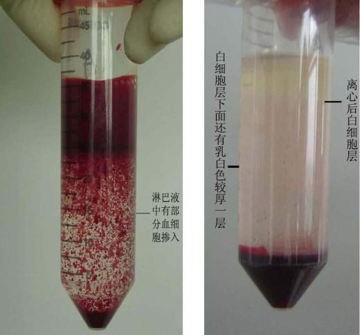 血液离心后分层图片图片