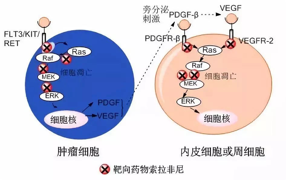 盘点:肝癌最新上市的靶向药物(一)_治疗