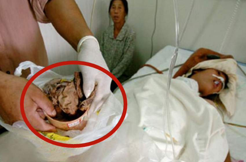 孕妇胎儿被撞出来图片图片