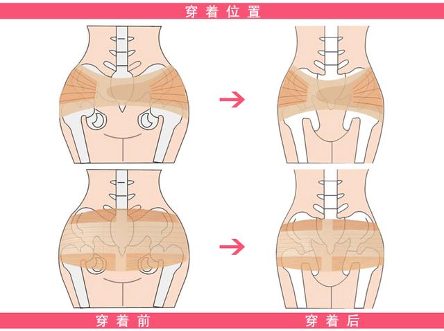 俗話說:屁股大好生養 真的嗎?生孩子,你是不是易分娩體質呢?